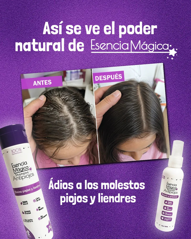 ESENCIA MÁGICA TRATAMIENTO ANTI PIOJOS