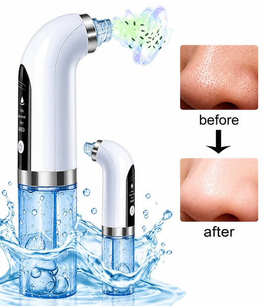 extractor de espinillas a vapor